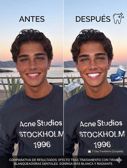 Tiras Blanqueadoras Dentales 20 Días – 20 Tiras